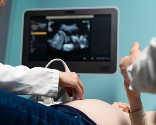 4d-colour-ultrasound