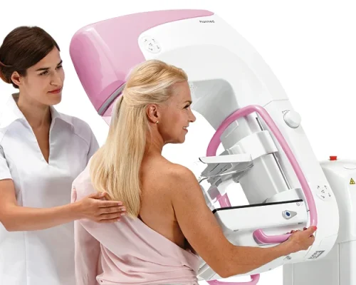 Digital Mammography