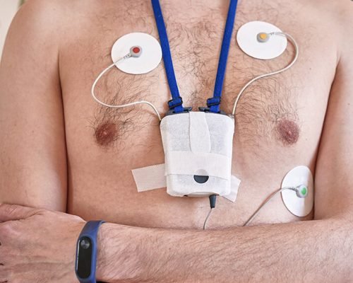 Holter Monitoring