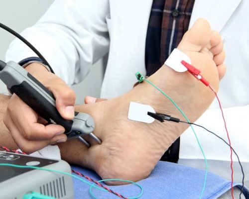 Somatosensory,Evoked,Potentials,(sep),Or,Nerve,Conduction,Velocity,(ncv),Is